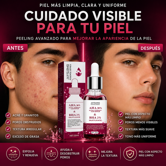 Jaysuing - Peeling facial AHA 30% + BHA 2%Ayuda a exfoliar la piel y mejorar la apariencia de la textura y los poros visibles.