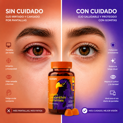Gomitas Luteína + Zeaxantina - Protección Visual Completa: Filtra Luz Azul, Previene Degeneración Macular y Reduce Cansancio Visual(60u)